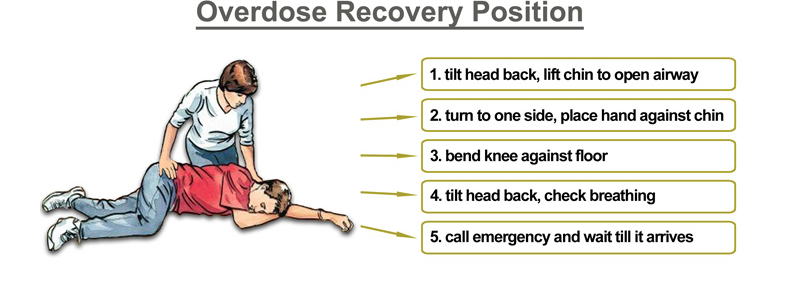 Overdose recovery position